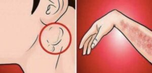 Obáváte se rakoviny? Naučte se číst ze svého těla. Toto je 15 varovných signálů, že se s vaším tělem něco děje!