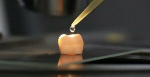 Konec plomb a výplním! Vědci vyvinuli převratnou novinku na regeneraci zubů