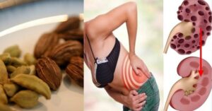 Stačí jediný doplněk kávy a zapomenete na problémy s ledvinami