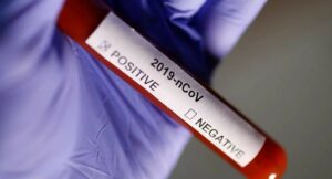 Jak dlouho koronavirus přežívá na předmětech? Nová studie naznačuje