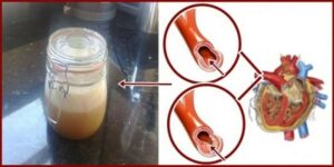 Rozlučte se s vysokým krevním tlakem a cholesterolem. Povíme vám jak