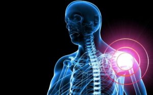 Jednoduchý trík proti bolestem ramene a krku