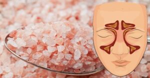 Inhalování této soli vám zastaví infekce dutin, sníží hleny a pomůže lépe spát