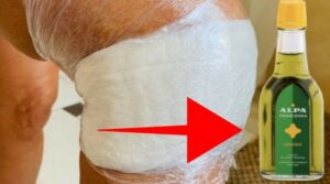 obklad z acylpyrinu a francovka