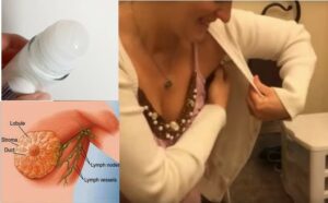 Bulky v podpaží kvůli používání deodorantu. Jaké nemoci může tento přípravek proti potu skutečně způsobit?