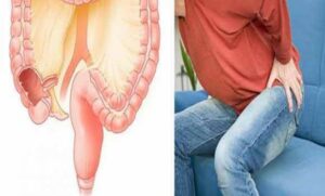 Rakovina tlustého střeva nepřichází z nenadání. Dbejte na těchto 5 varovných signálů svého těla.