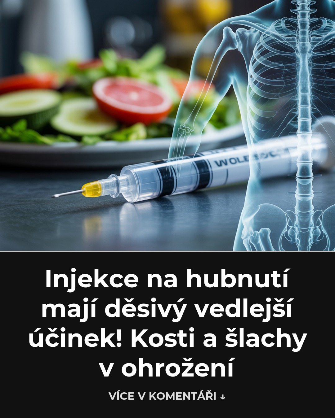Injekce na hubnutí mají děsivý vedlejší účinek! Kosti a šlachy v ohrožení