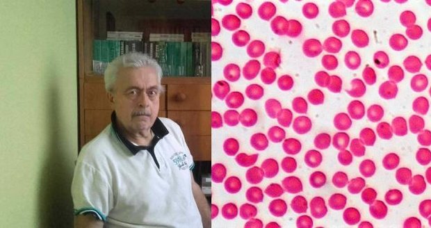 Hemofilie se v Jaroslavově rodině dědí přes generace