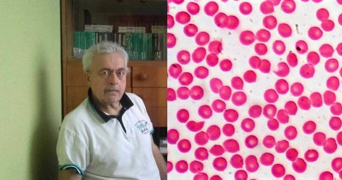 Jaroslav z Vrchlabí trpí těžkou formou hemofilie