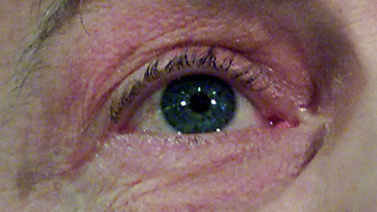 Záhadný virus z moře napadá lidské oči