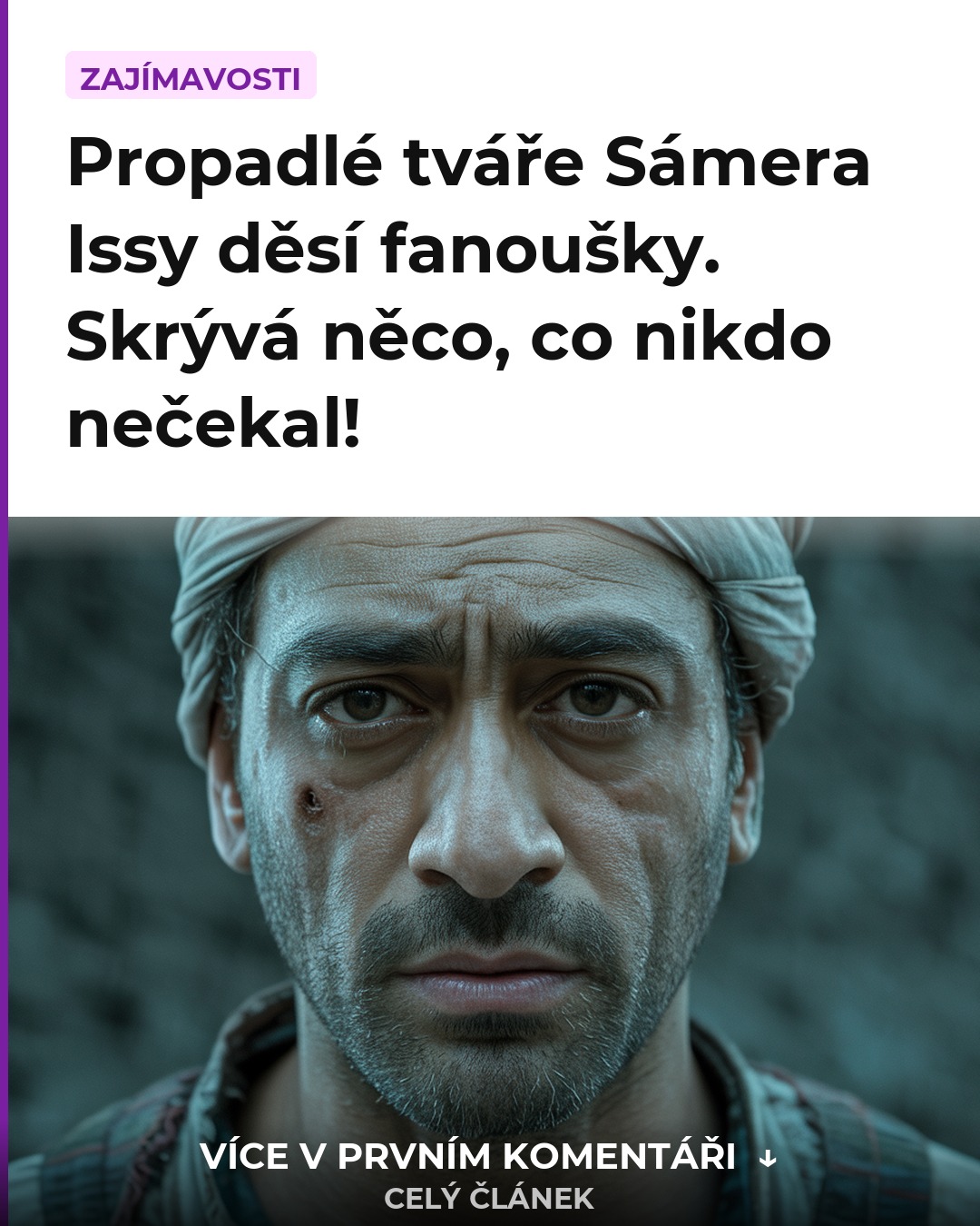 Propadlé tváře Sámera Issy děsí fanoušky. Skrývá něco, co nikdo nečekal!