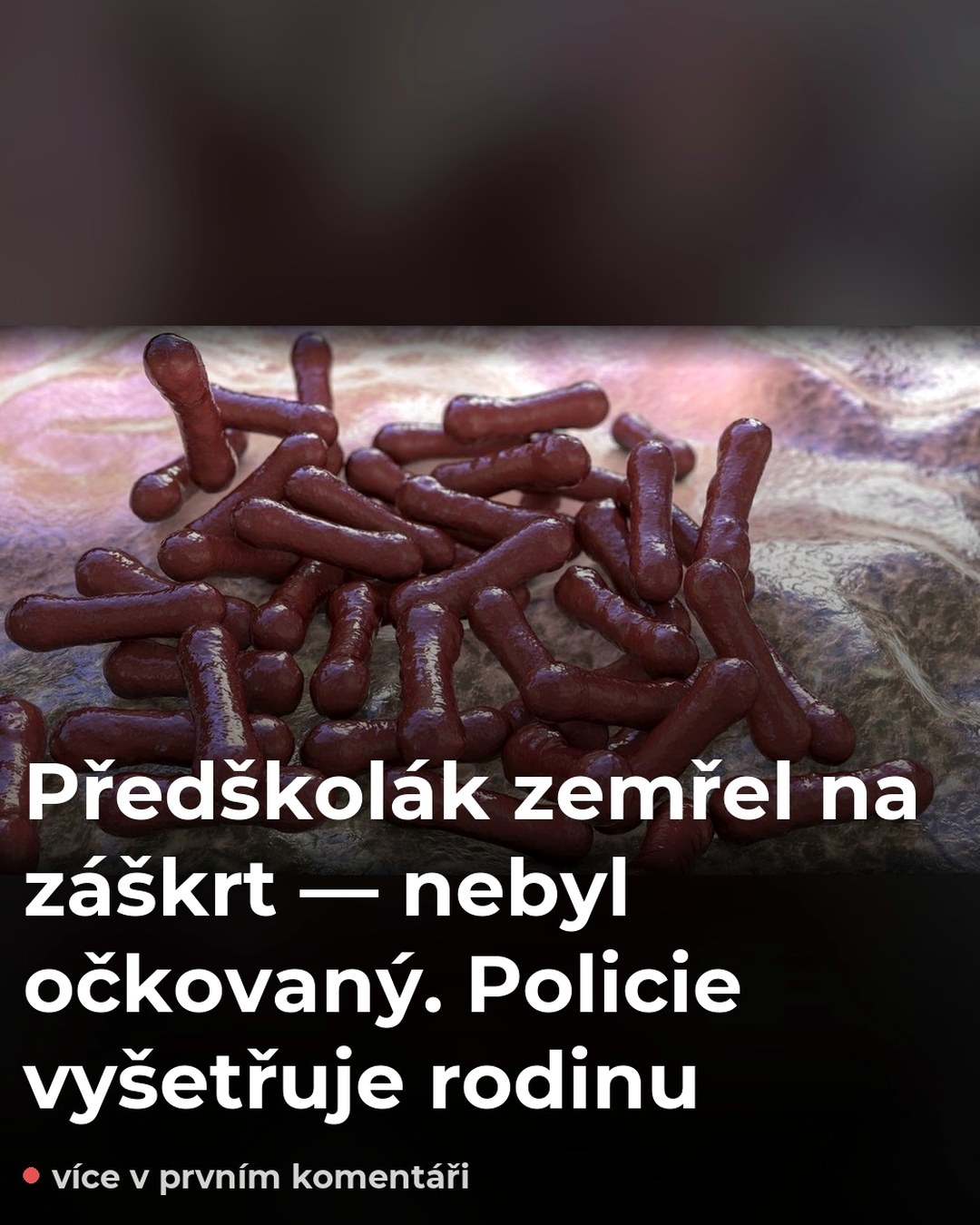 Předškolák zemřel na záškrt — nebyl očkovaný. Policie vyšetřuje rodinu
