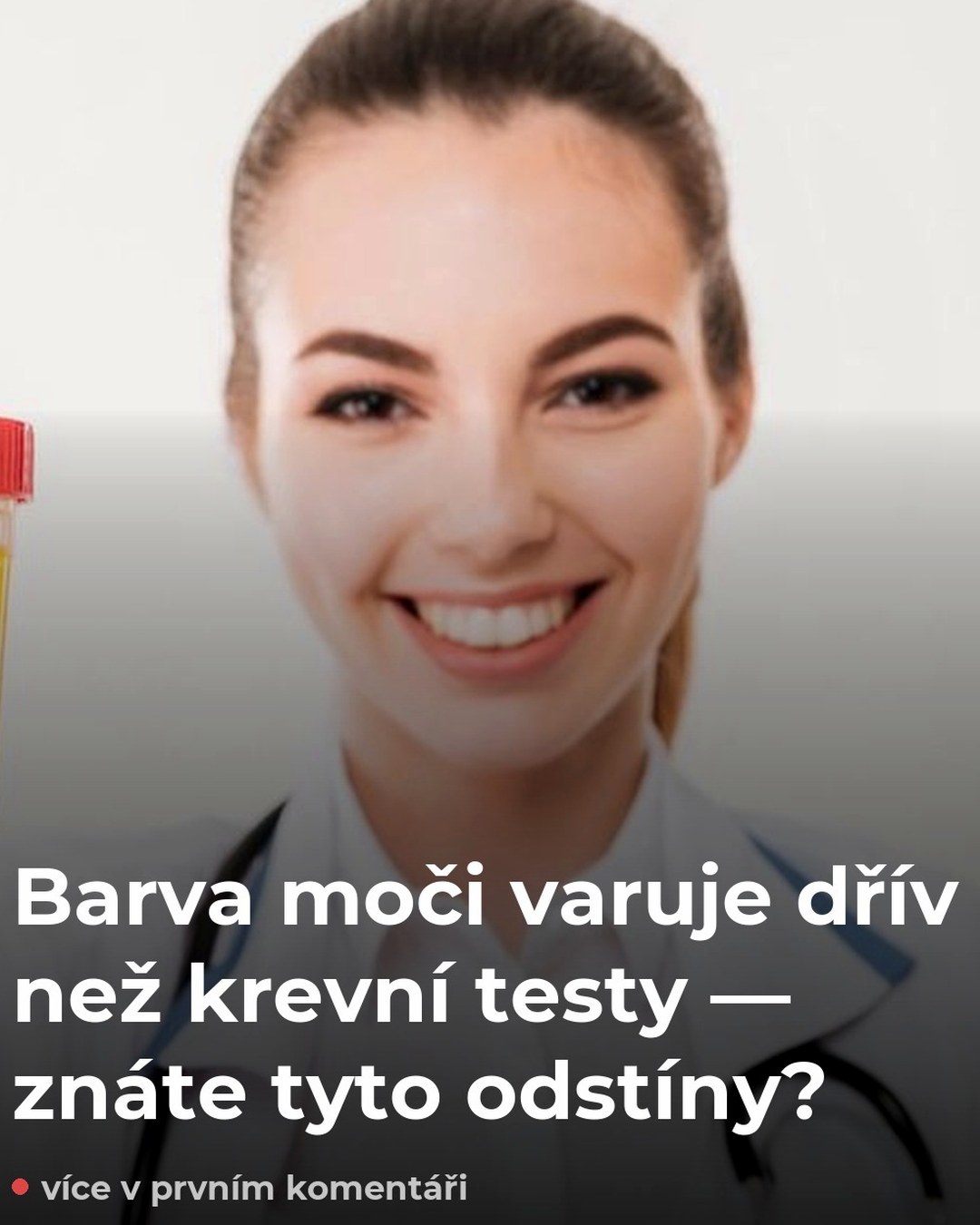 Barva moči varuje dřív než krevní testy — znáte tyto odstíny?