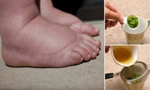 10 přírodních rostlin, které pomáhají s otoky nohou a zadržováním vody