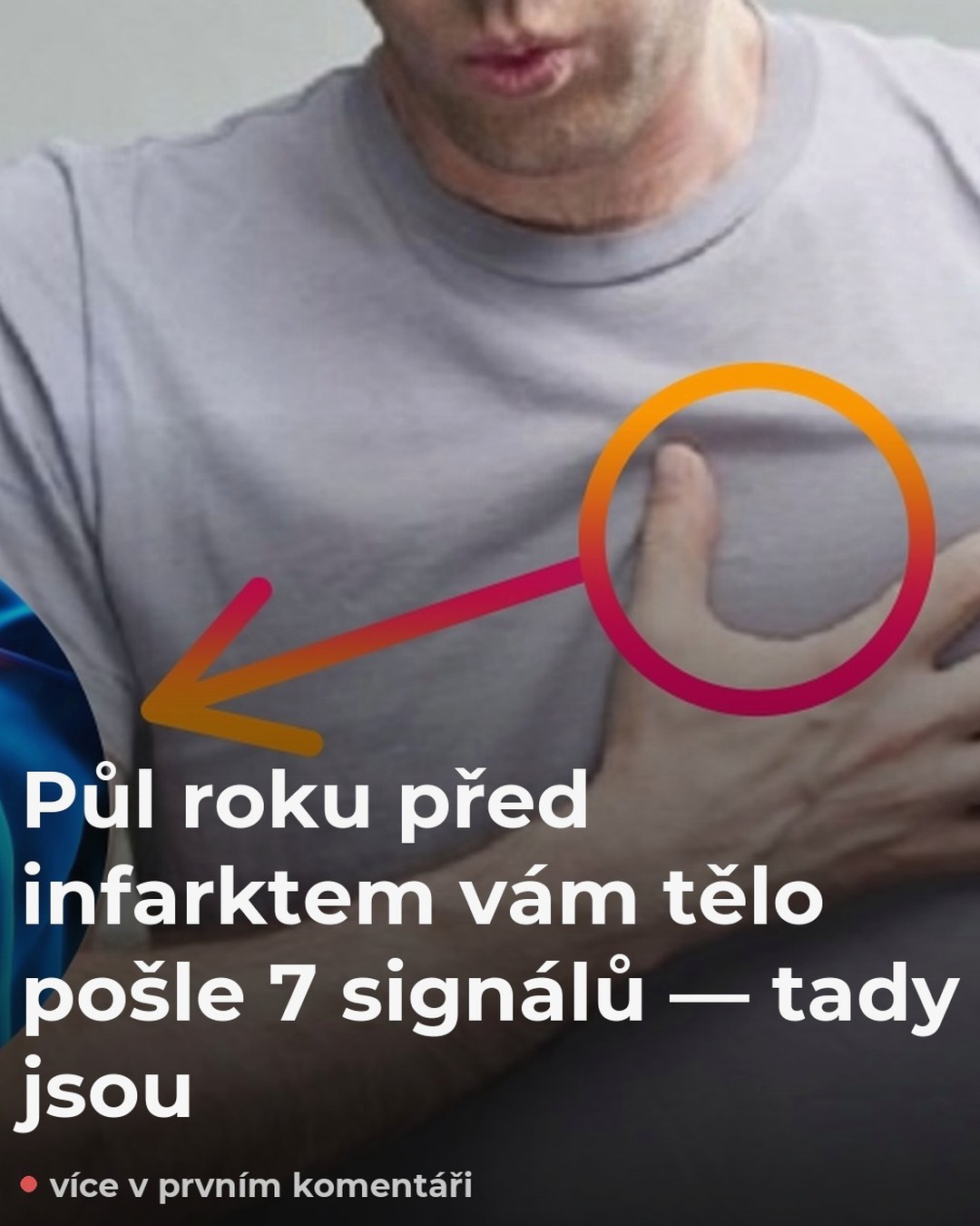 Půl roku před infarktem vám tělo pošle 7 signálů — tady jsou