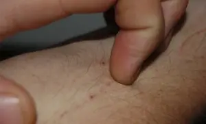 15 varovných příznaků, které by vás měly poslat k lékaři co nejdříve
