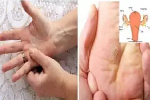Rakovina děložního čípku: až 15 let bez příznaků – co každá žena musí vědět