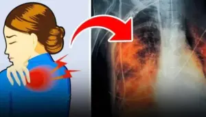 3 typy bolesti, které lidé podceňují a mohou signalizovat rakovinu plic
