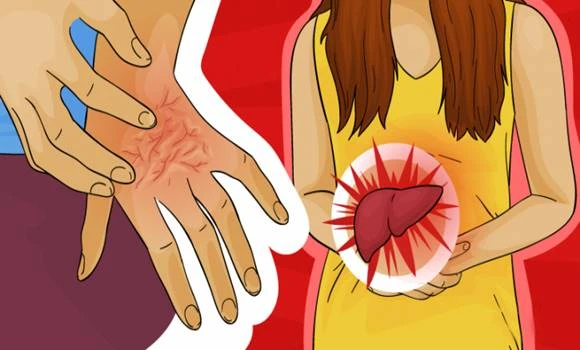 Svědění kůže: 7 zdravotních příčin, které byste neměli ignorovat
