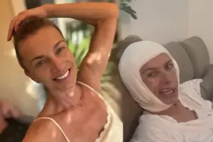 Alice Bendová po faceliftu za statisíce: výsledek operace tváře je konečně jasný