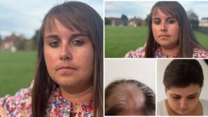 Becky podstupovala chemoterapiu 11 rokov – rakovinu mozgu však nikdy nemala! Ako sa mohol takýto omyl stať a čo z toho plynie?