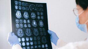 Čínsky lekár možno objavil liečbu Alzheimera – a potom záhadne zmizol vo väzení! Čo sa deje za zatvorenými dverami čínskych kliník?
