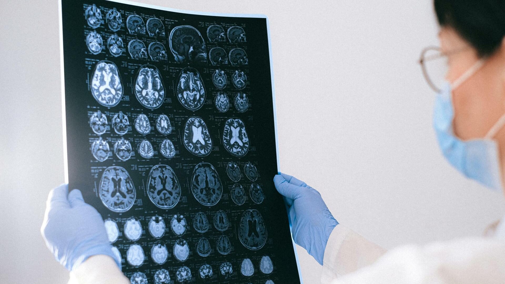 Čínsky lekár možno objavil liečbu Alzheimera – a potom záhadne zmizol vo väzení! Čo sa deje za zatvorenými dverami čínskych kliník?