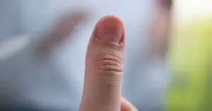 Pozrite sa na svoje nechty: môžu odhaliť stav zdravia aj to, ako dlho budete žiť