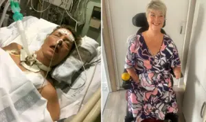 Z infekce močových cest dostala sepsi: žena přišla o všechny čtyři končetiny
