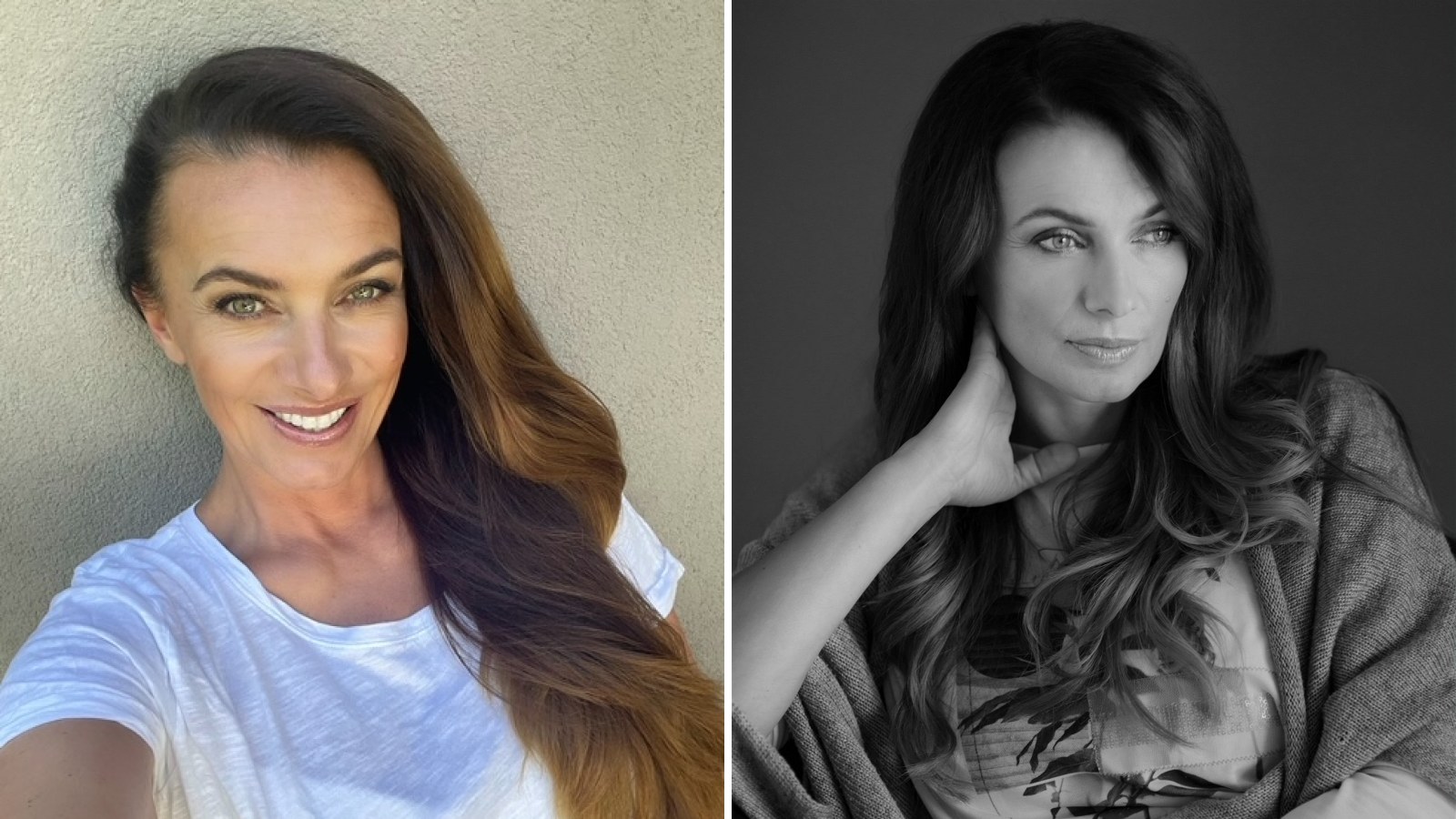 Alice Bendová promluvila o ceně faceliftu: za nový obličej dala pořádný balík! Kolik přesně zaplatila a co ji překvapilo nejvíc?