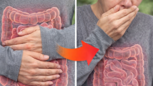 Rakovina tlustého střeva příznaky, které se nesmí přehlížet: může klamat dlouhé měsíce! Lékaři varují před signály, které lidé berou jako běžný trávicí problém