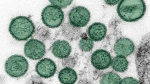 Zákeřný virus se šíří Evropou: v 16 zemích jsou stovky nakažených! Hrozí nám v Česku?