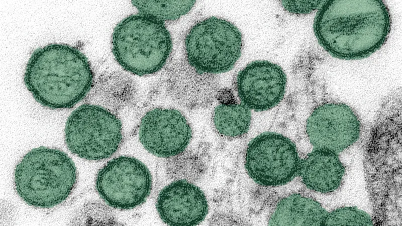 Zákeřný virus se šíří Evropou: v 16 zemích jsou stovky nakažených! Hrozí nám v Česku?